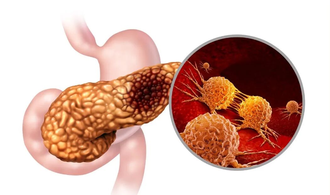 176768263481338516.jpg 5e91c6c28752cf67285be704fc1403e5.jpg